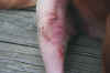 Bo's Suture the next day after licking at it after stitch Removal 1 (02-2001).JPG (89064 bytes)